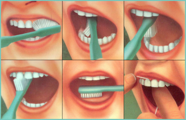 3) обрабатываемые зубы надо изолировать от 